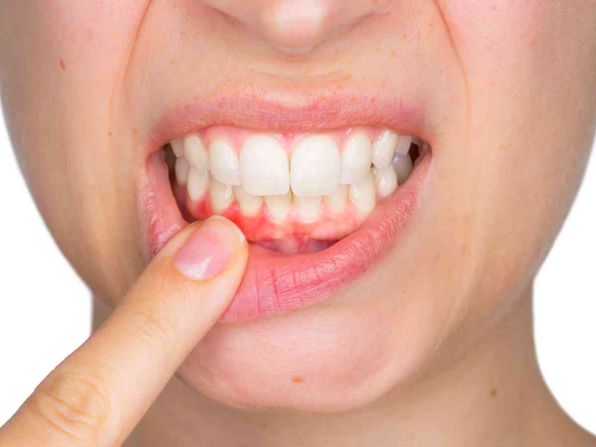 When are gums&nbsp;inflamed?